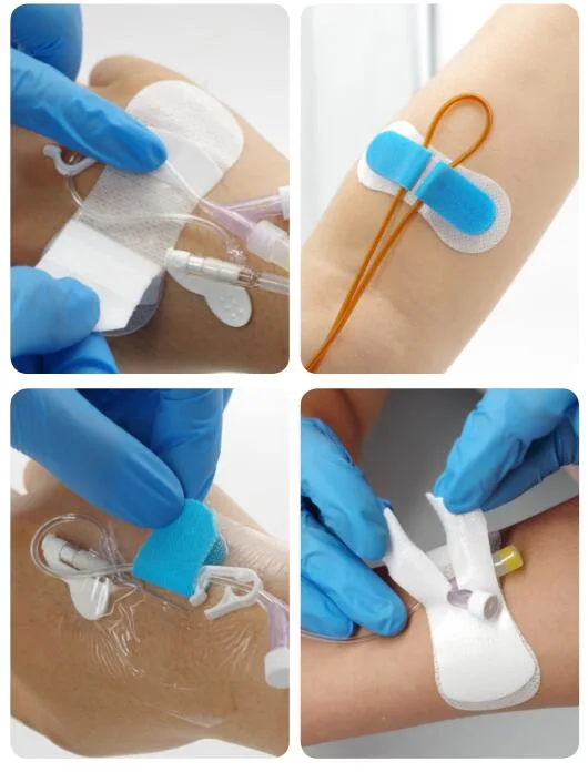Catheter Fixation Dressing for Urethral Catheter Surgical Instrument Holder